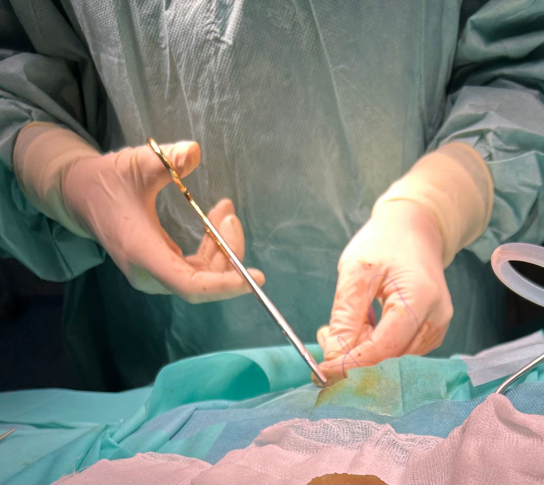 Intervenţie salvatoare a medicilor de la Spitalul Judeţean Arad pentru o tânără mamă de 29 de ani