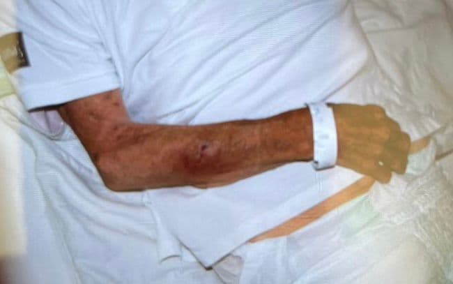Mărturii cutremurătoare despre pacienţii exploataţi de reţeaua din Bihor - Pacient cu traumatism cranian vechi de trei zile, fără asistenţă medicală. Medicul şef UPU SMURD Bihor: Pe unii îi abandonau în gara din Oradea sau în UPU ca să scape de ei