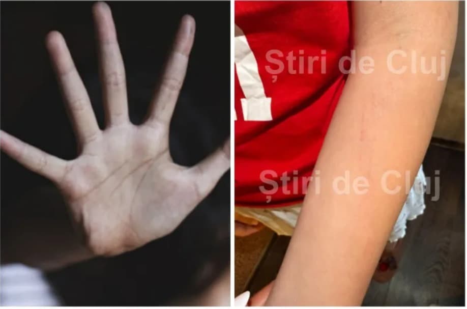 Cluj: Anchetă a Poliţiei, după ce o tânără care a participat balul de absolvire a liceului a ajuns la spital, reclamând că a fost violată. Reprezentanţii unităţii de primiri urgenţe au anunţat autorităţile