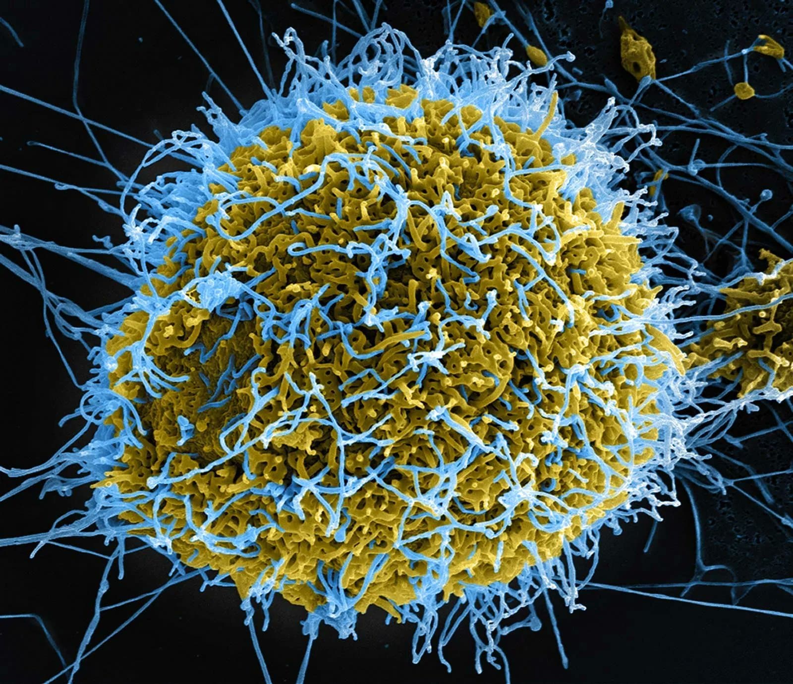 Aproape 500 de cazuri de Ebola confirmate în Africa Centrală (OMS)