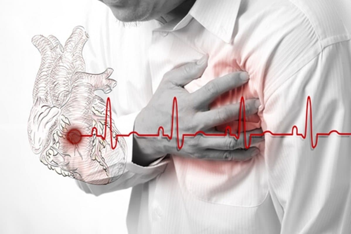 A ajuns la medic la două zile după infarct, convins că la 36 de ani nu e în pericol, însă a decedat. Medicii avertizează: tot mai mulți tineri cu boli cardiace. „Majoritatea, fumători sau obezi”