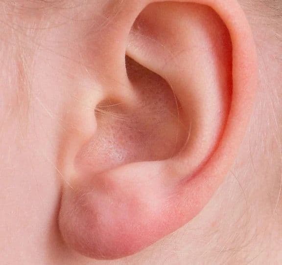 Surditatea, reversibilă: o singură injecţie restabileşte auzul în doar câteva săptămâni