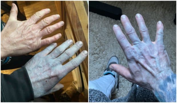 A ajuns la Urgențe cu pielea albastră și a fost pus pe oxigen. Ce au descoperit medicii: „Le-am oferit un motiv de râs”