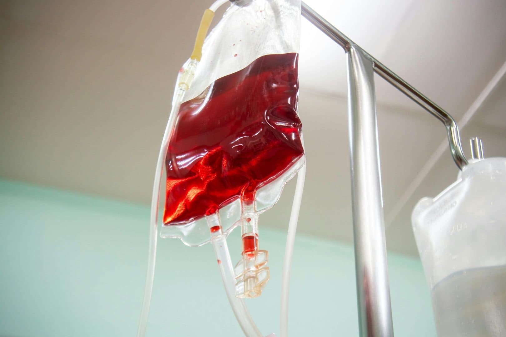 Anchetă după moartea unui pacient din cauza unei transfuzii. Asistent medical ATI dat în judecată