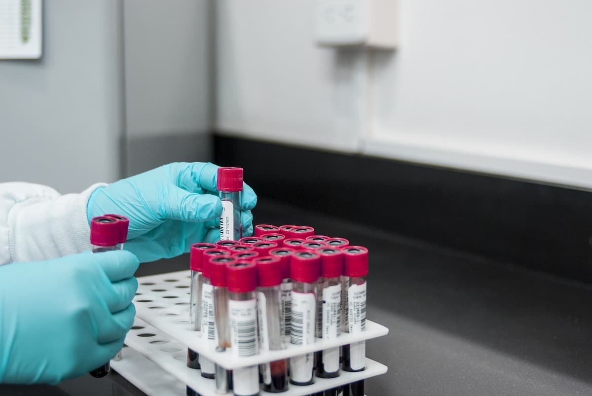 Suspiciune de hantavirus la un pacient internat din 2023 într-o unitate de psihiatrie din Arad / Din 2023 până acum s-au înregistrat alte 15 cazuri în România