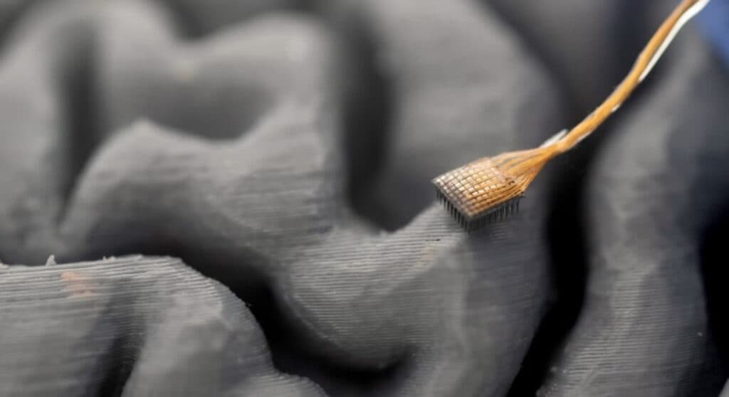 China transformă implanturile cerebrale cu inteligență artificială în produse comerciale
