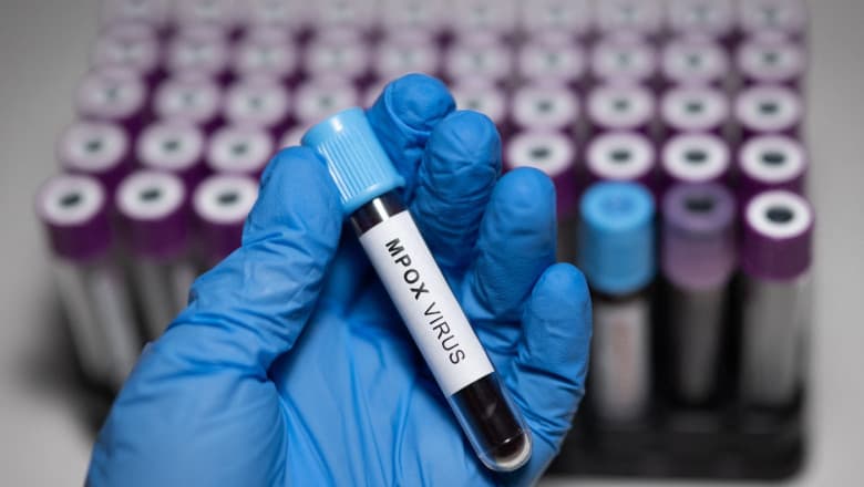 Doi oameni de știință, acuzați că au adus ilegal în SUA fiole cu virus mpox dezactivat din Africa și au mințit autoritățile