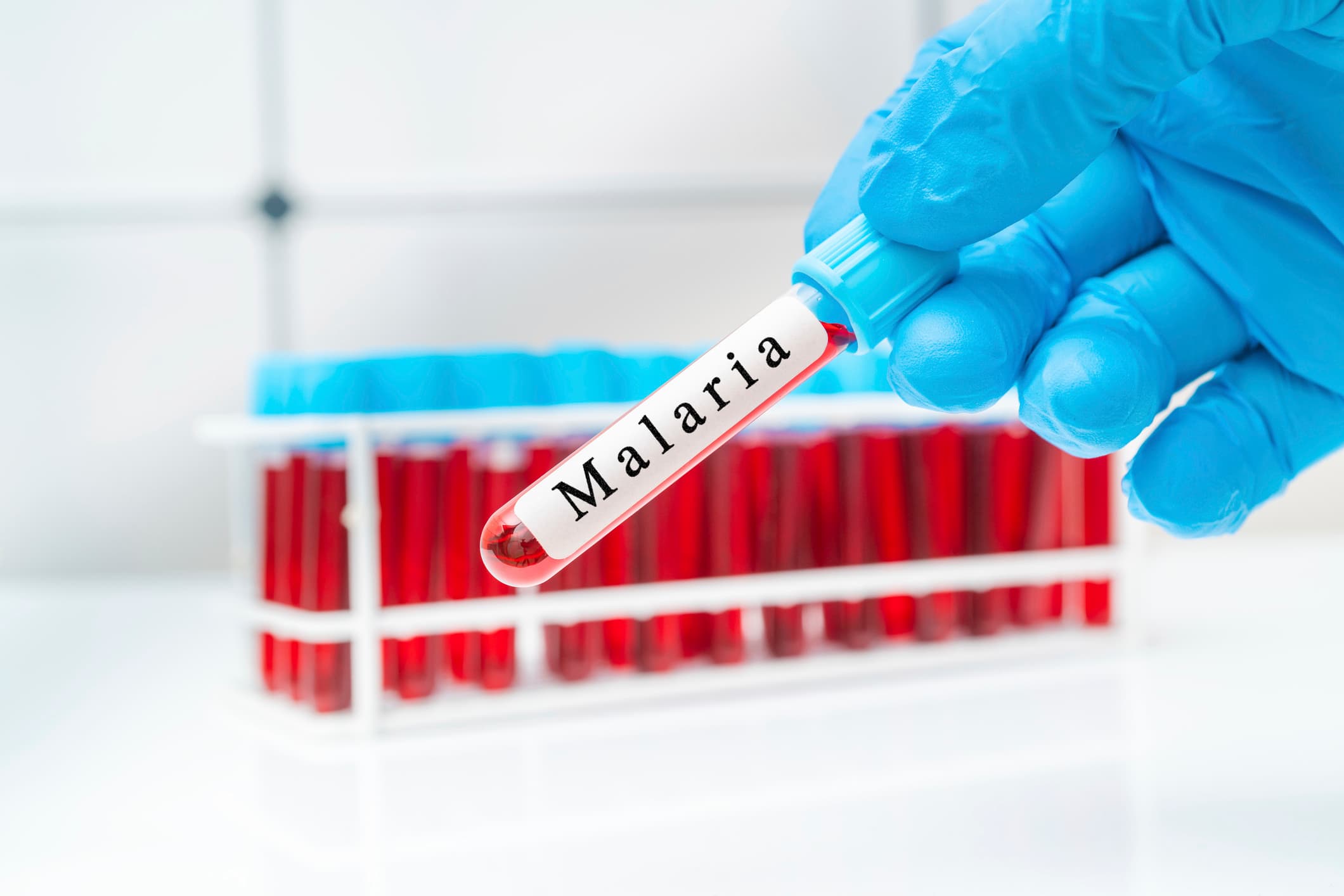 OMS aprobă, în premieră, un medicament împotriva malariei destinat sugarilor