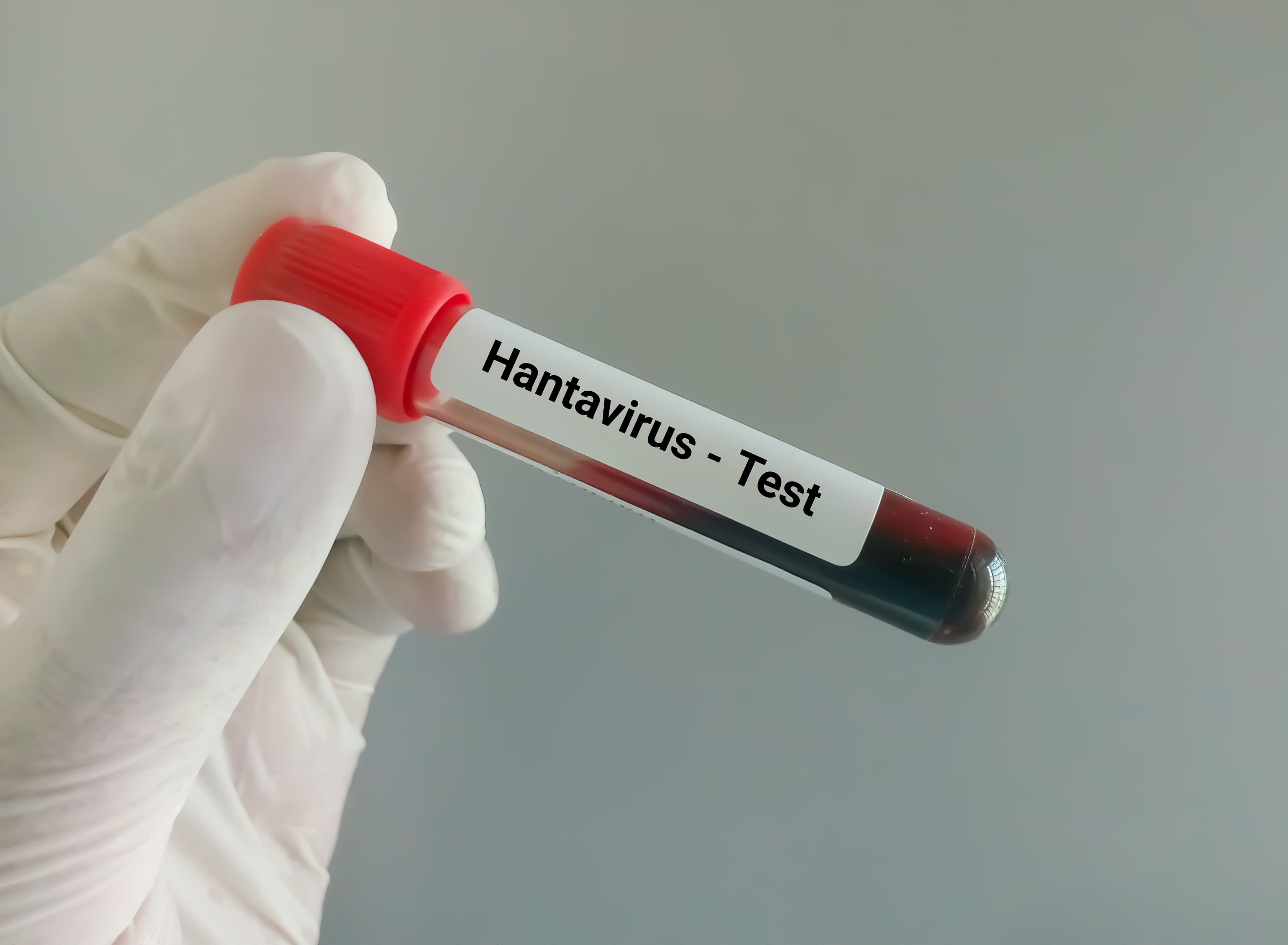 Suspiciune de hantavirus la Arad. Autorităţile au declanşat o anchetă epidemiologică. Ce spun medicii despre tulpina virusului