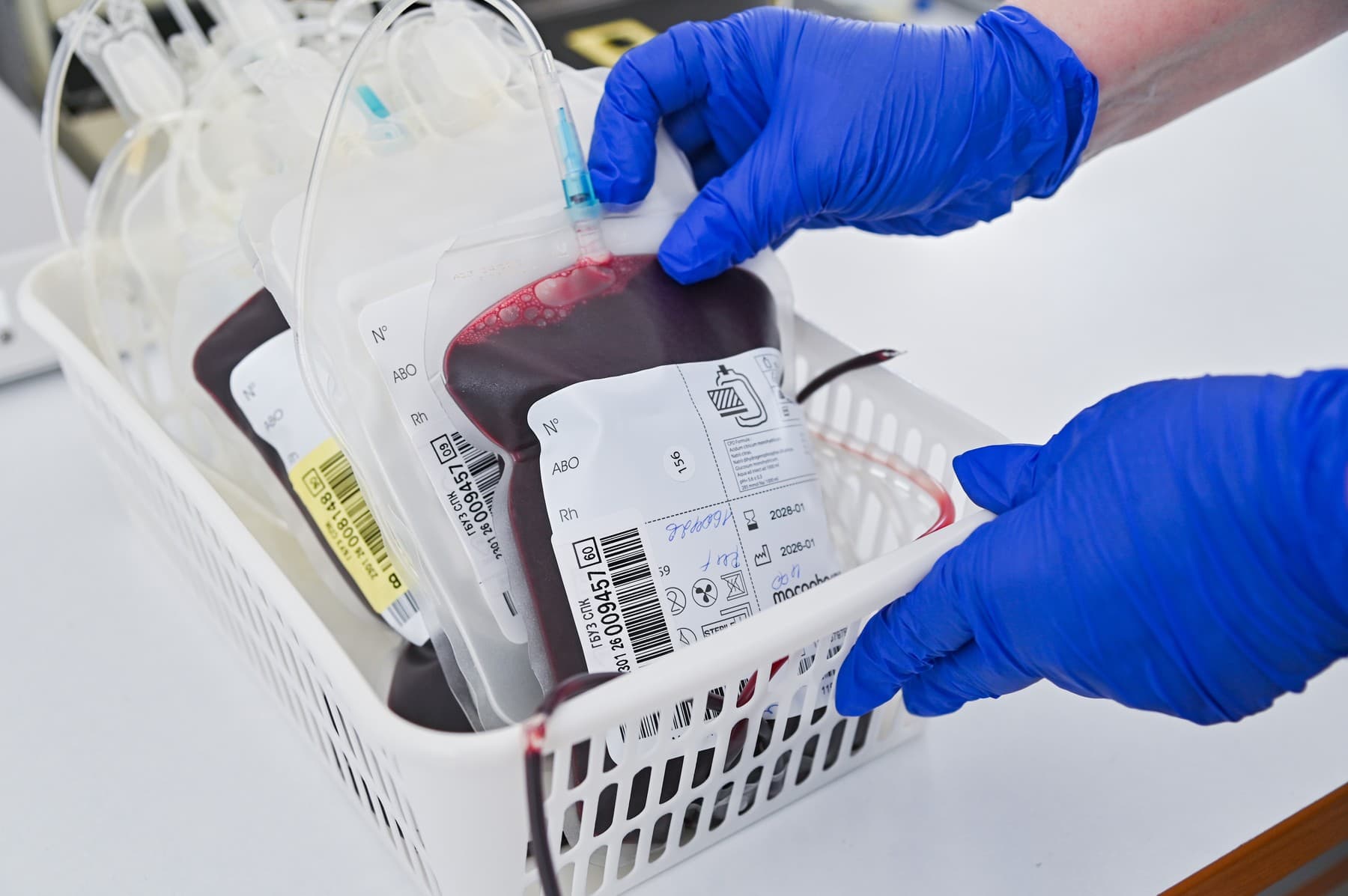Pacient mort după o transfuzie cu sânge incompatibil. Asistent ATI trimis în judecată pentru ucidere din culpă