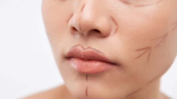 Sancțiuni maxime aplicate pentru cabinetul privat din București unde o pacientă a murit în urma unui „minilifting facial”