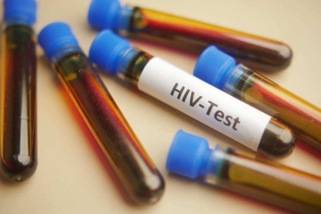 Un nou medicament ar putea ține HIV sub control timp de doi ani