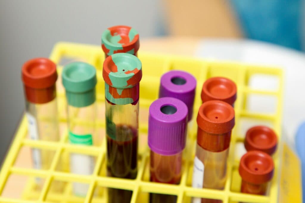 Aproape o treime din angajații în sănătate din Europa se confruntă cu risc de cancer la locul de muncă