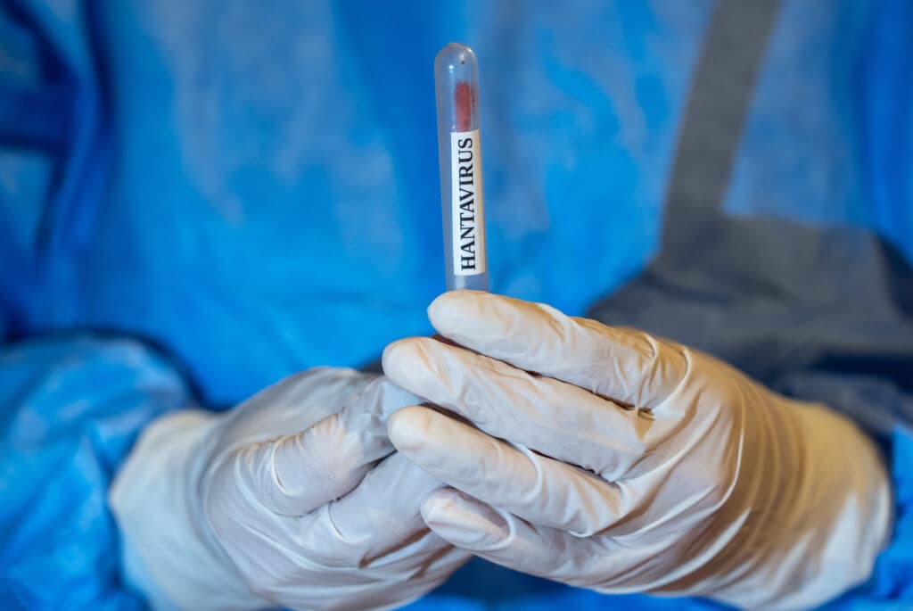 Femeia internată într-un spital din Alicante din cauza suspiciunii de hantavirus a ieșit negativă la testul PCR. Ce urmează